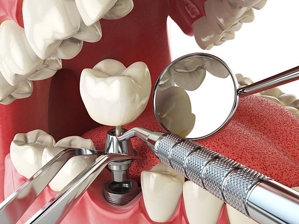 Best Emergency Broken Tooth Repair in Edgewater, FL